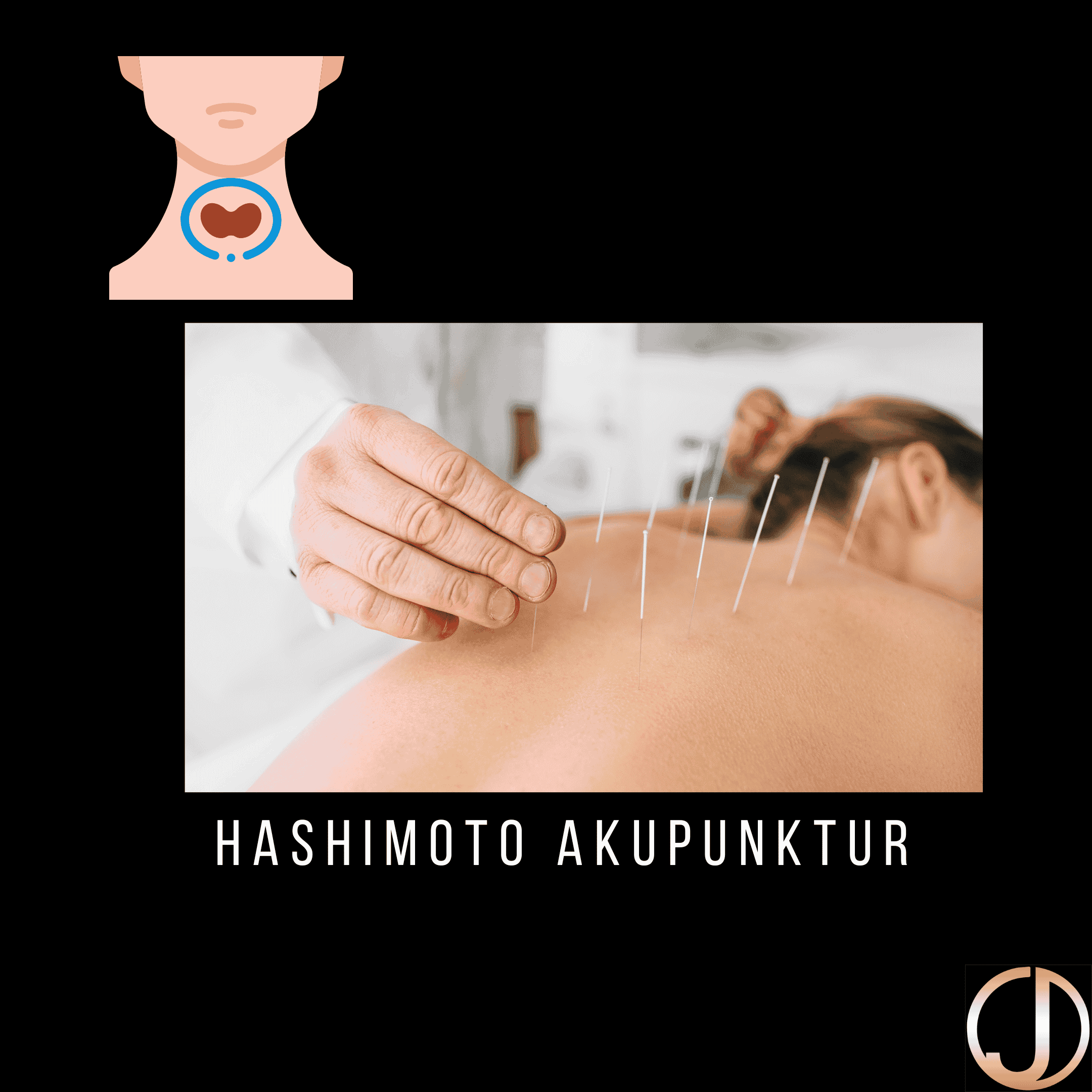 hashimoto akupunktur